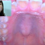 【HD】街角で声をかけて口内観察させてもらう　アパレル関係　ひなみちゃん